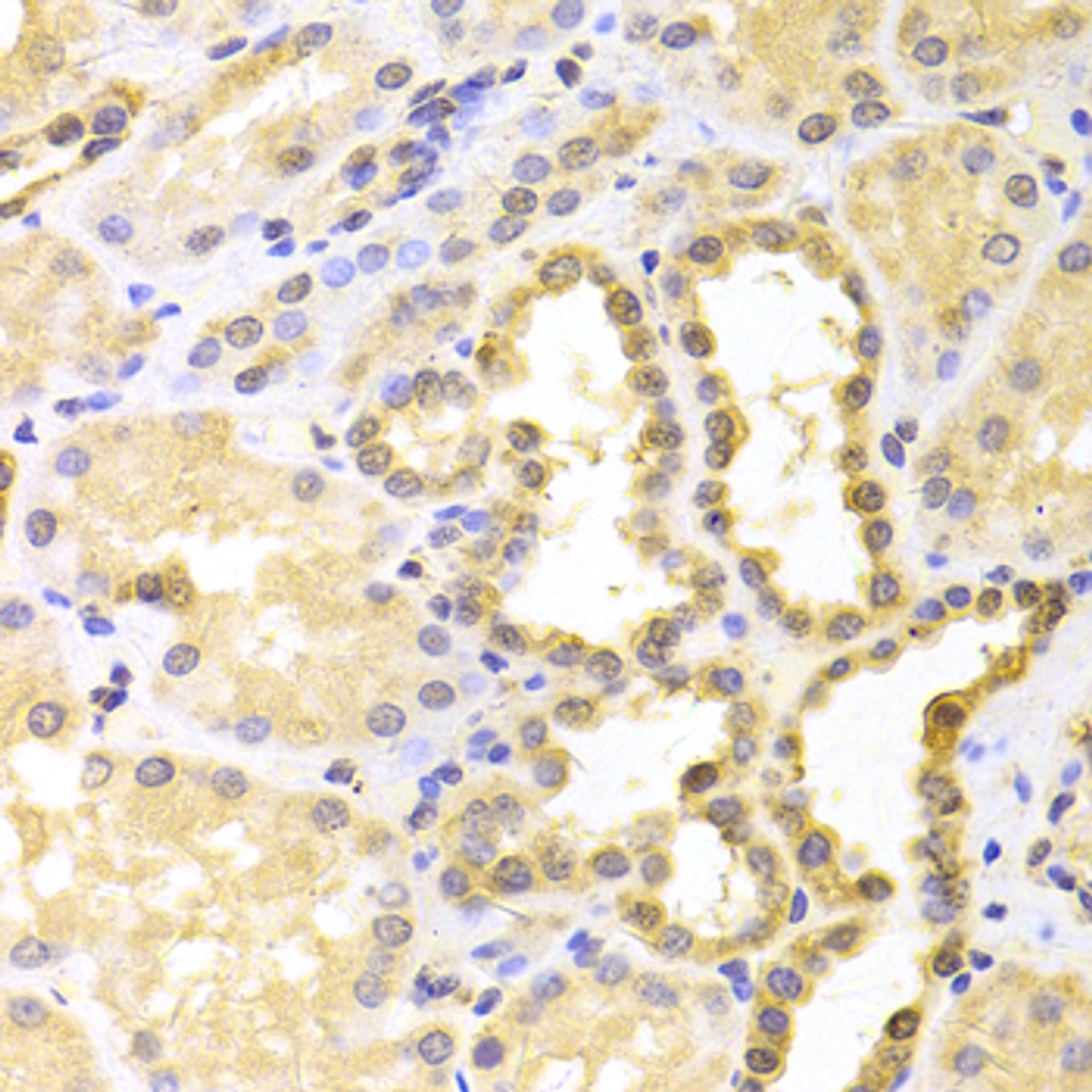 Immunohistochemistry of paraffin-embedded Human kidney using S100A11 Polyclonal Antibody at dilution of  1:100 (40x lens).