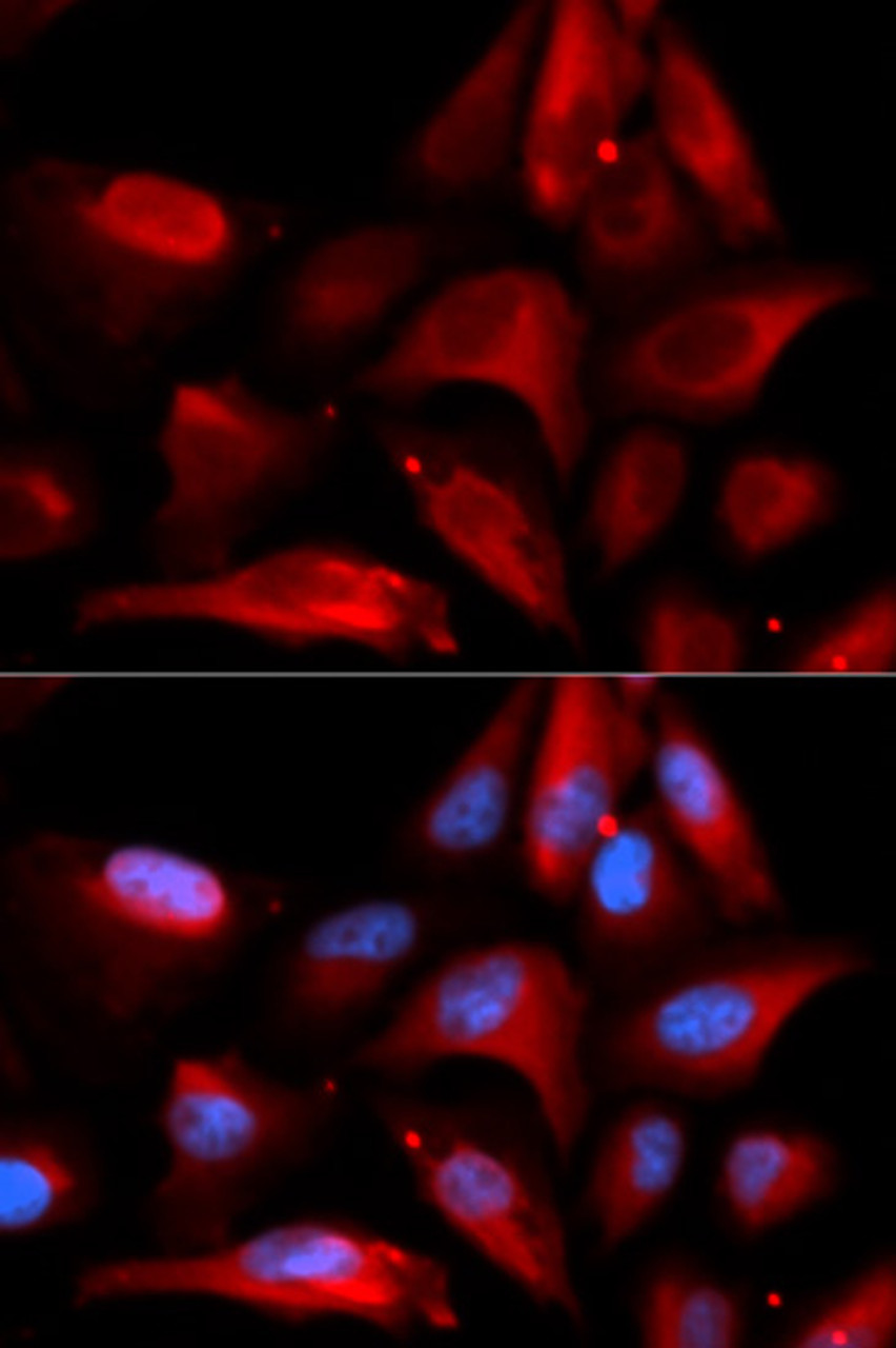 Immunofluorescence analysis of U2OS cells using S100A11 Polyclonal Antibody