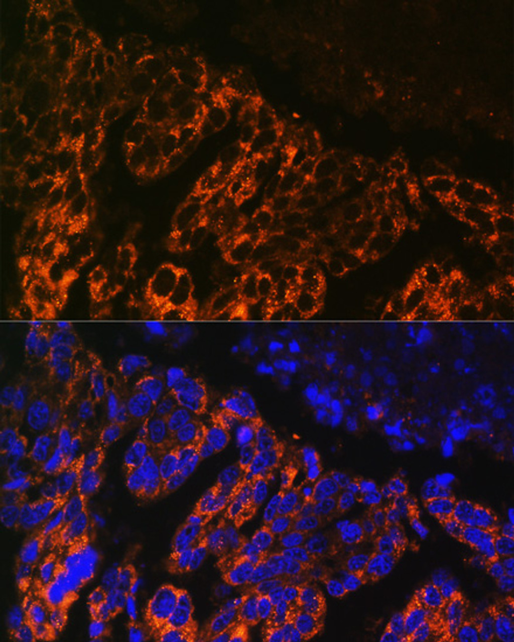 Immunofluorescence analysis of Human lung cancer cells using SCNN1A Polyclonal Antibody at dilution of  1:100. Blue: DAPI for nuclear staining.