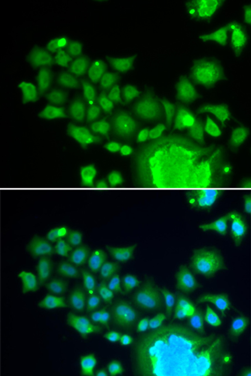 Immunofluorescence analysis of HeLa cells using FZR1 Polyclonal Antibody