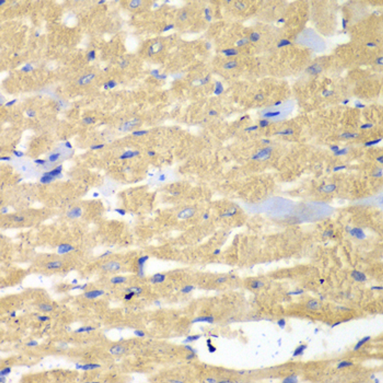 Immunohistochemistry of paraffin-embedded Mouse heart using HAX1 Polyclonal Antibody at dilution of  1:100 (40x lens).
