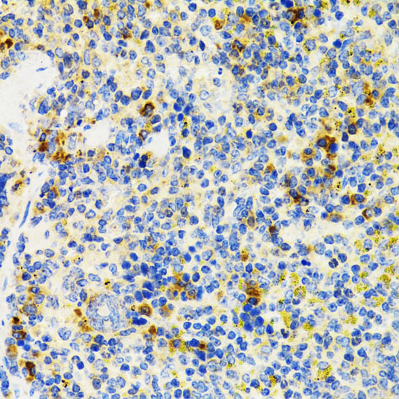 Immunohistochemistry of paraffin-embedded Mouse spleen using SH2B1 Polyclonal Antibody at dilution of  1:100 (40x lens).