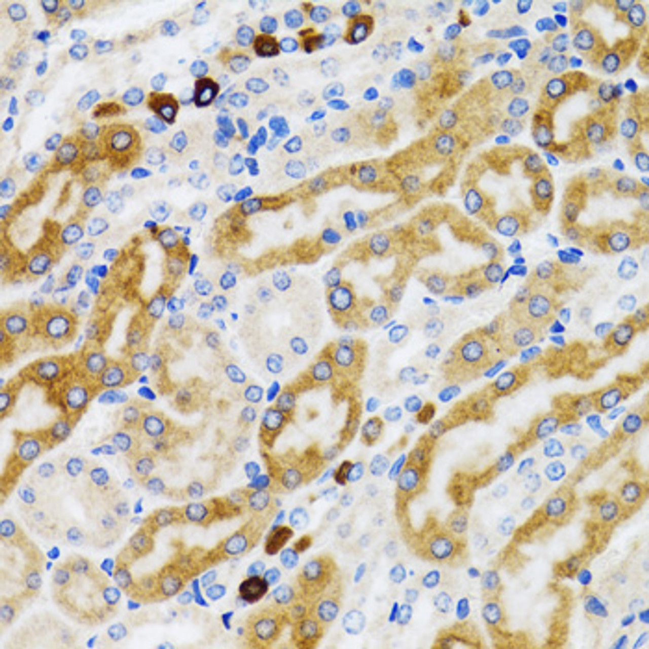 Immunohistochemistry of paraffin-embedded Rat kidney using PGRMC1 Polyclonal Antibody at dilution of  1:100 (40x lens).