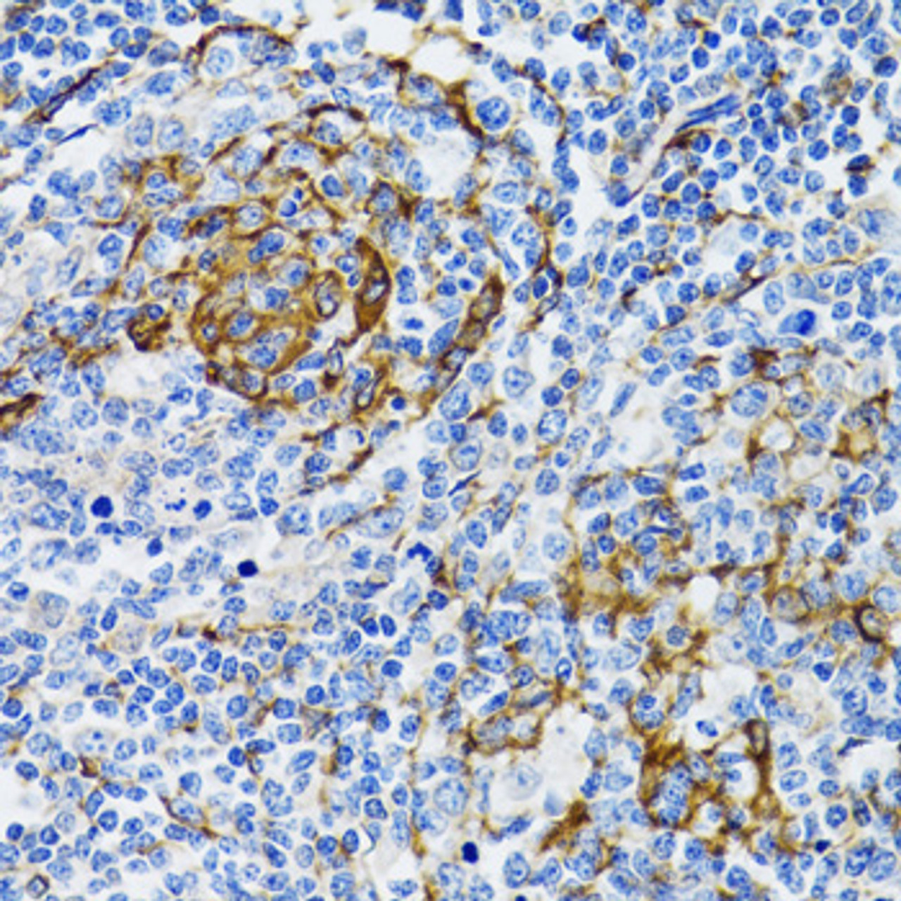 Immunohistochemistry of paraffin-embedded Human tonsil using PGRMC1 Polyclonal Antibody at dilution of  1:100 (40x lens).