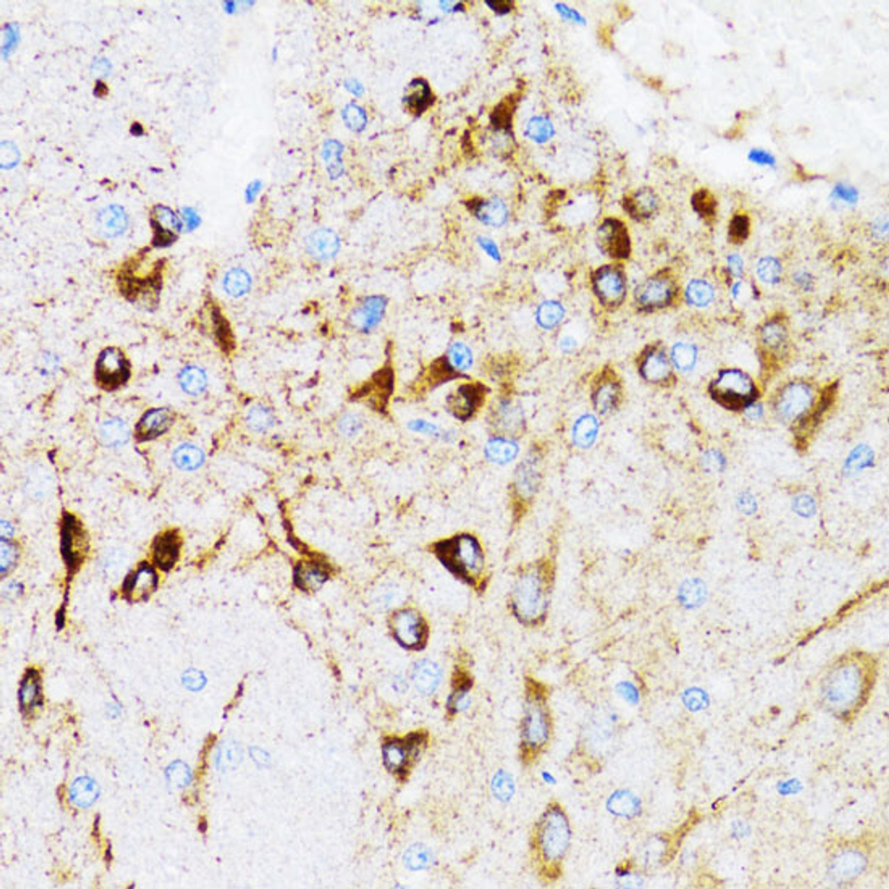 Immunohistochemistry of paraffin-embedded Mouse brain using PGRMC1 Polyclonal Antibody at dilution of  1:100 (40x lens).