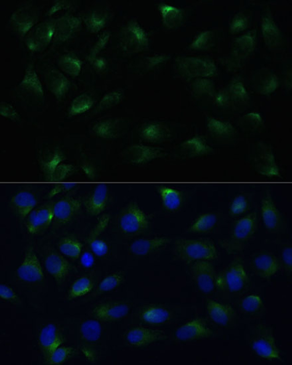 Immunofluorescence analysis of C6 cells using PGRMC1 Polyclonal Antibody at dilution of  1:100 (40x lens). Blue: DAPI for nuclear staining.