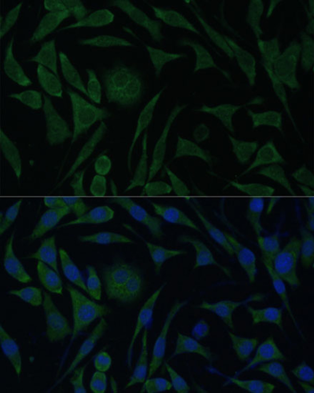 Immunofluorescence analysis of L929 cells using PGRMC1 Polyclonal Antibody at dilution of  1:100 (40x lens). Blue: DAPI for nuclear staining.
