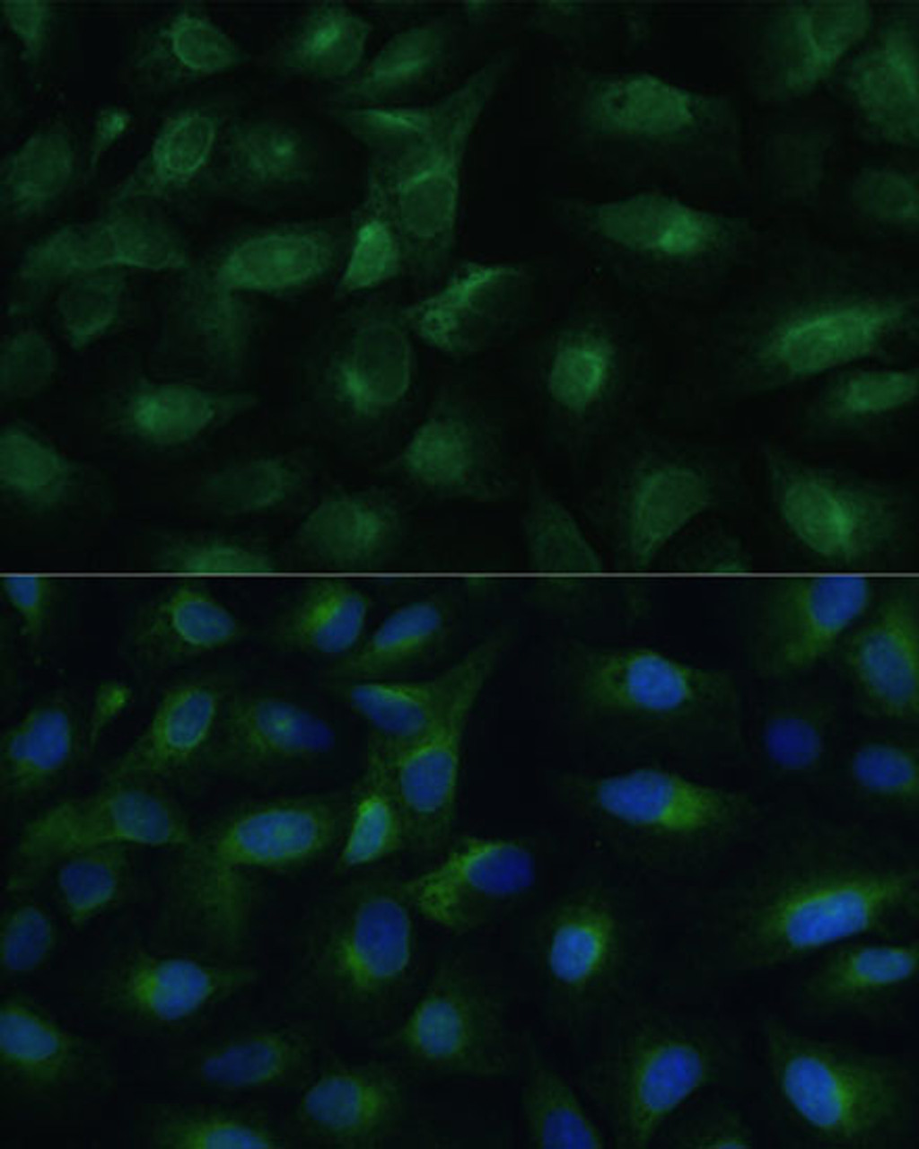 Immunofluorescence analysis of U-2 OS cells using PGRMC1 Polyclonal Antibody at dilution of  1:100 (40x lens). Blue: DAPI for nuclear staining.