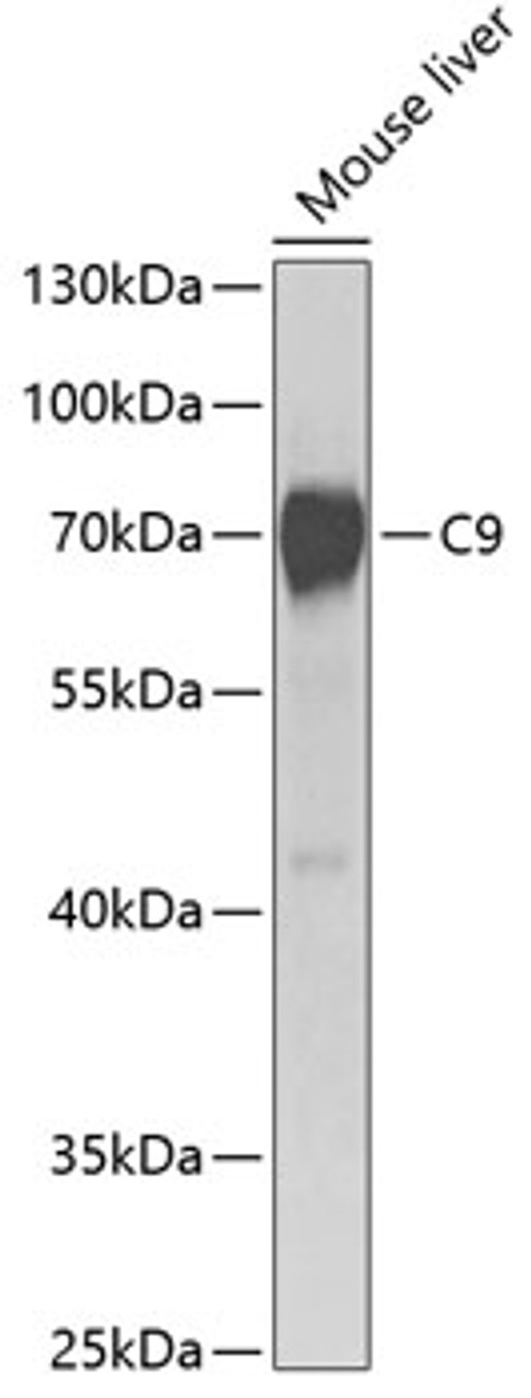 Western blot analysis of extracts of Mouse liver using C9 Polyclonal Antibody at dilution of 1:1000.