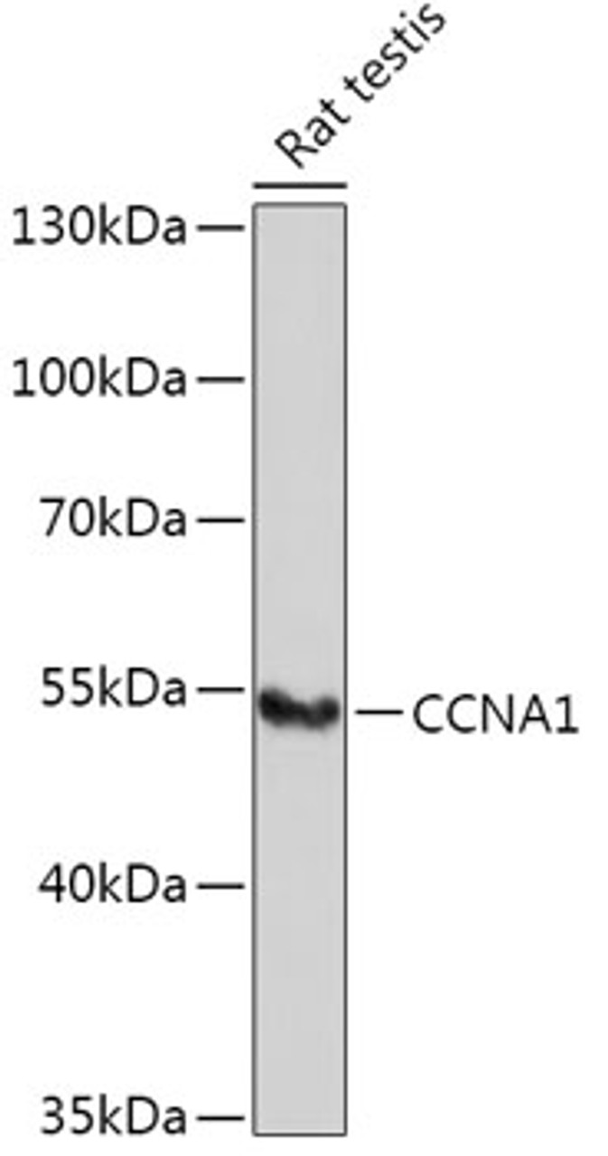 Western blot analysis of extracts of Rat testis using CCNA1 Polyclonal Antibody at dilution of 1:1000.