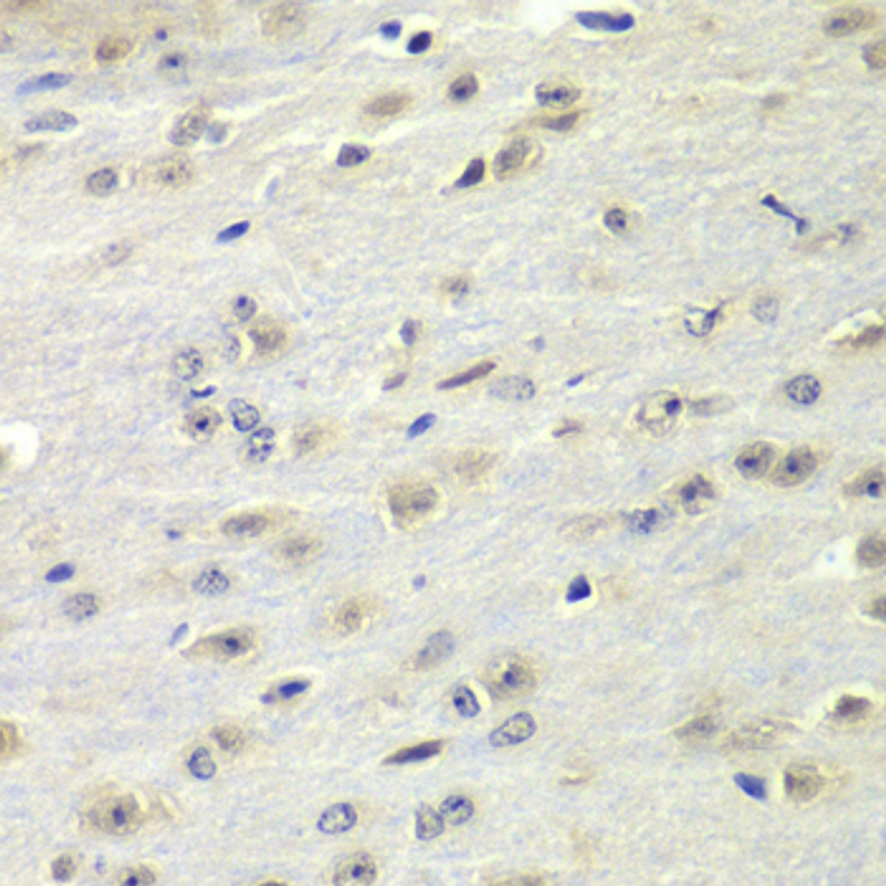 Immunohistochemistry of paraffin-embedded Mouse brain using FMR1 Polyclonal Antibody at dilution of  1:100 (40x lens).