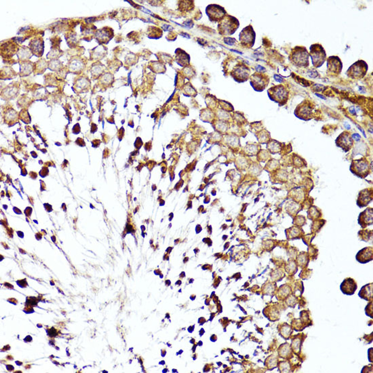 Immunohistochemistry of paraffin-embedded Rat testis using MME Polyclonal Antibody at dilution of  1:100 (40x lens).