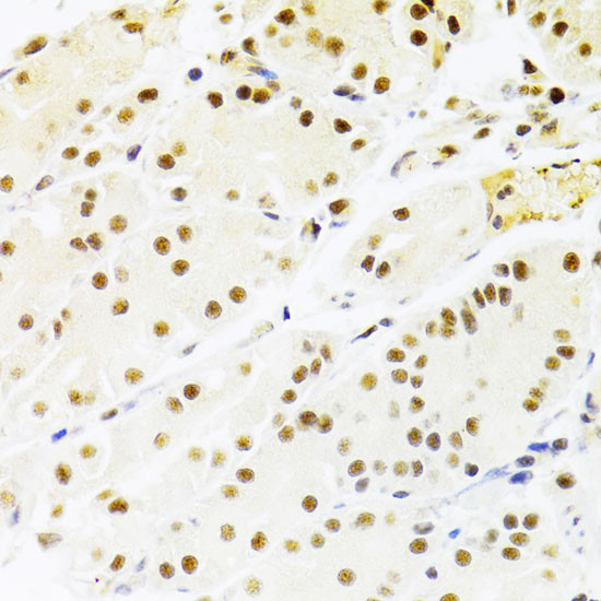 Immunohistochemistry of paraffin-embedded Human stomach using RBPJ Polyclonal Antibody at dilution of  1:100 (40x lens).