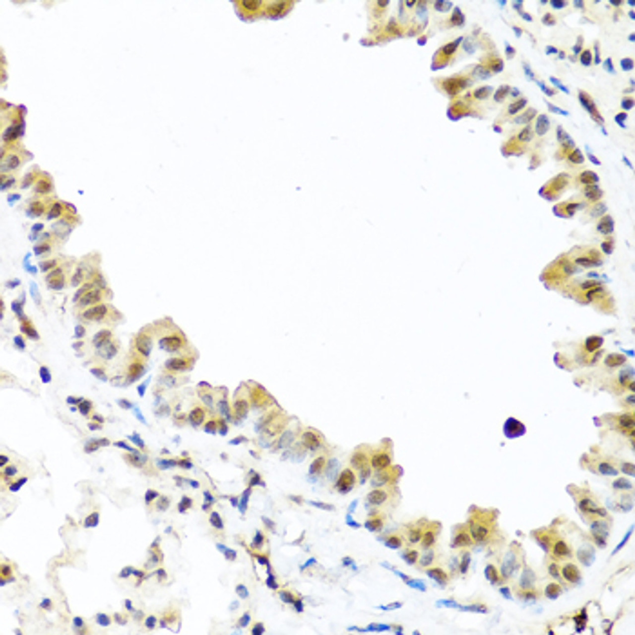 Immunohistochemistry of paraffin-embedded Mouse lung using TET2 Polyclonal Antibody at dilution of  1:100 (40x lens).