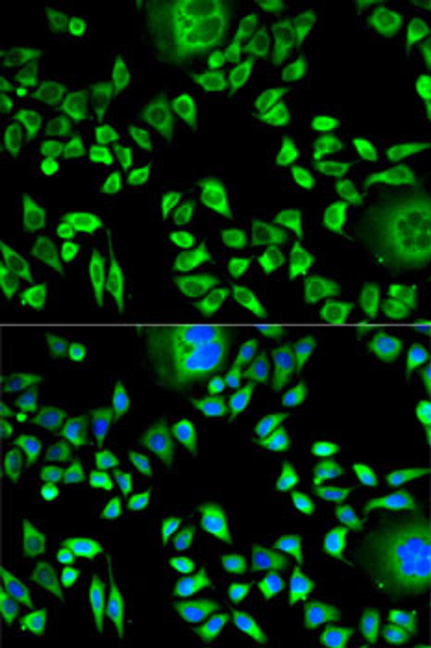 Immunofluorescence analysis of HeLa cells using CSTA Polyclonal Antibody