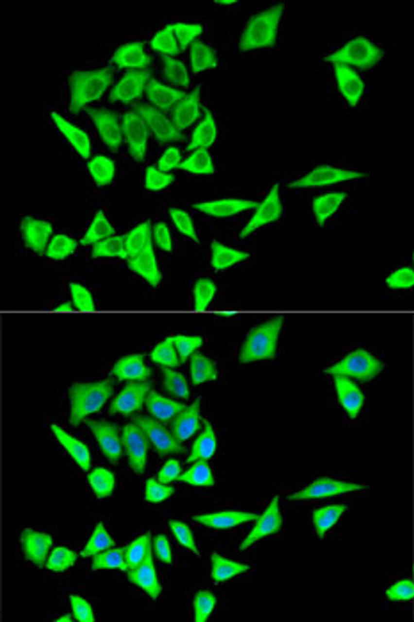 Immunofluorescence analysis of HeLa cells using GRB2 Polyclonal Antibody