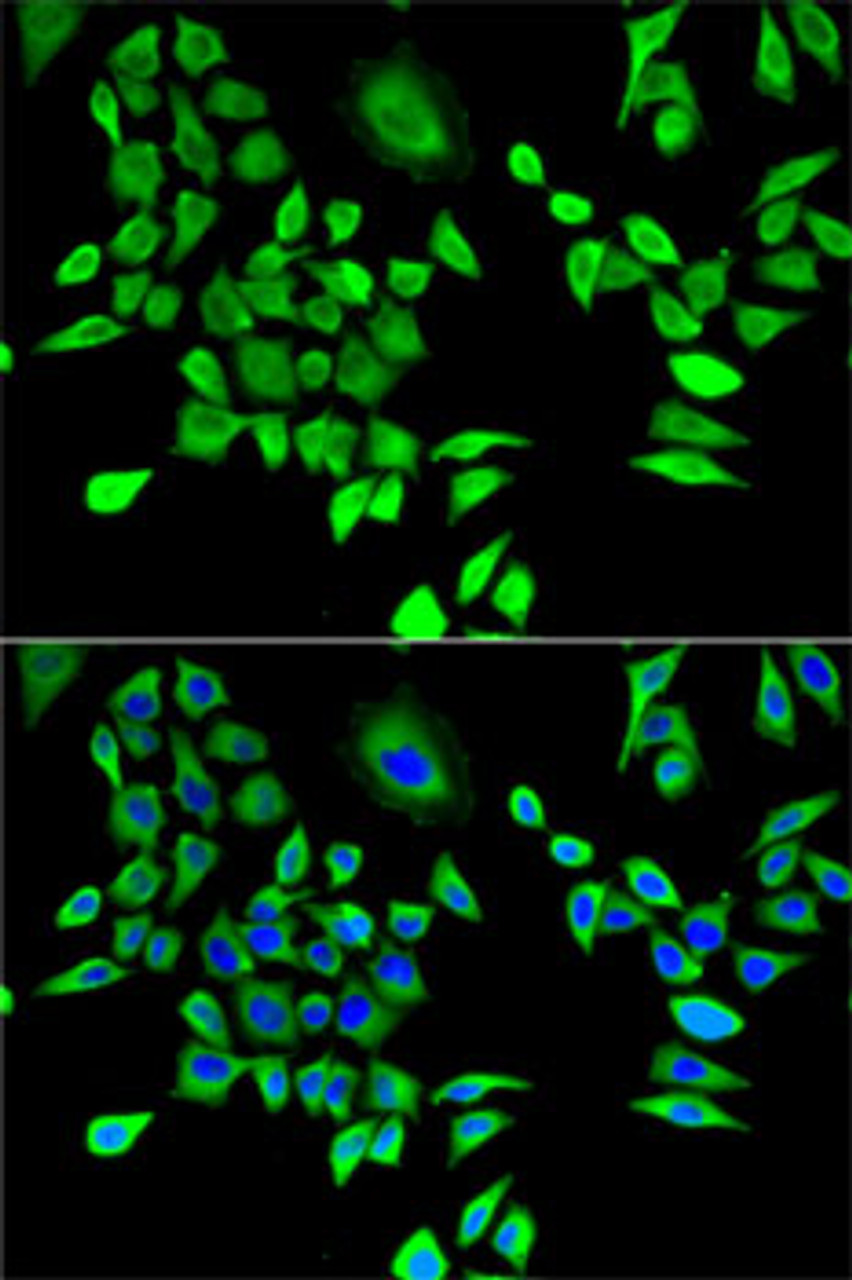 Immunofluorescence analysis of U2OS cells using HPRT1 Polyclonal Antibody