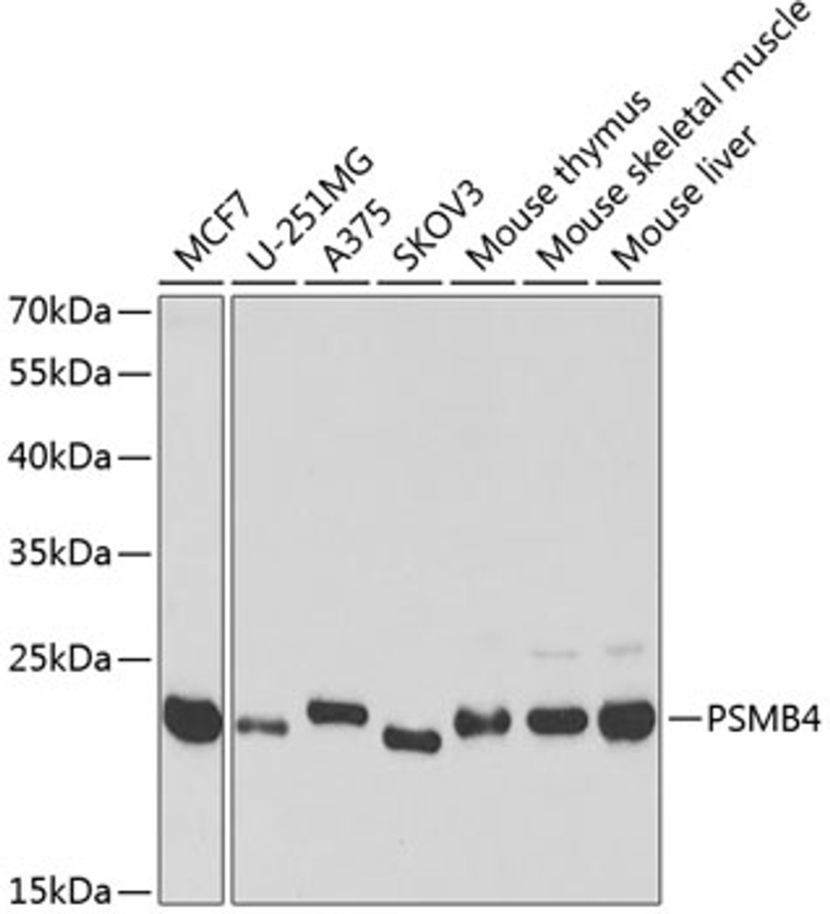 Western blot analysis of extracts of various cell lines using PSMB4 Polyclonal Antibody at dilution of 1:1000.