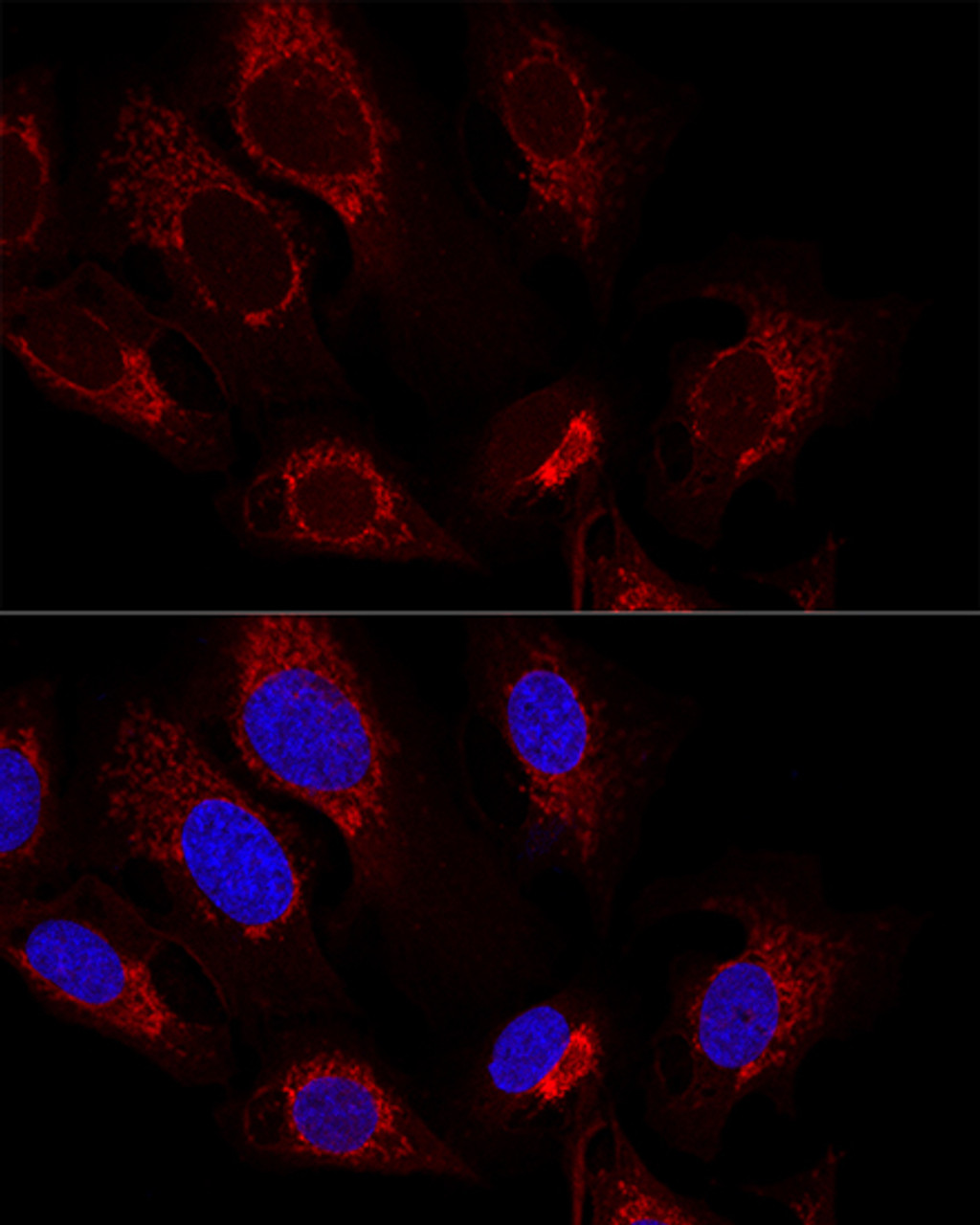 Confocal immunofluorescence analysis of U2OS cells using CS Polyclonal Antibody at dilution of  1:100. Blue: DAPI for nuclear staining.