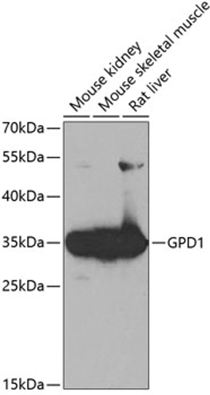 Western blot analysis of extracts of various cell lines using GPD1 Polyclonal Antibody at dilution of 1:1000.