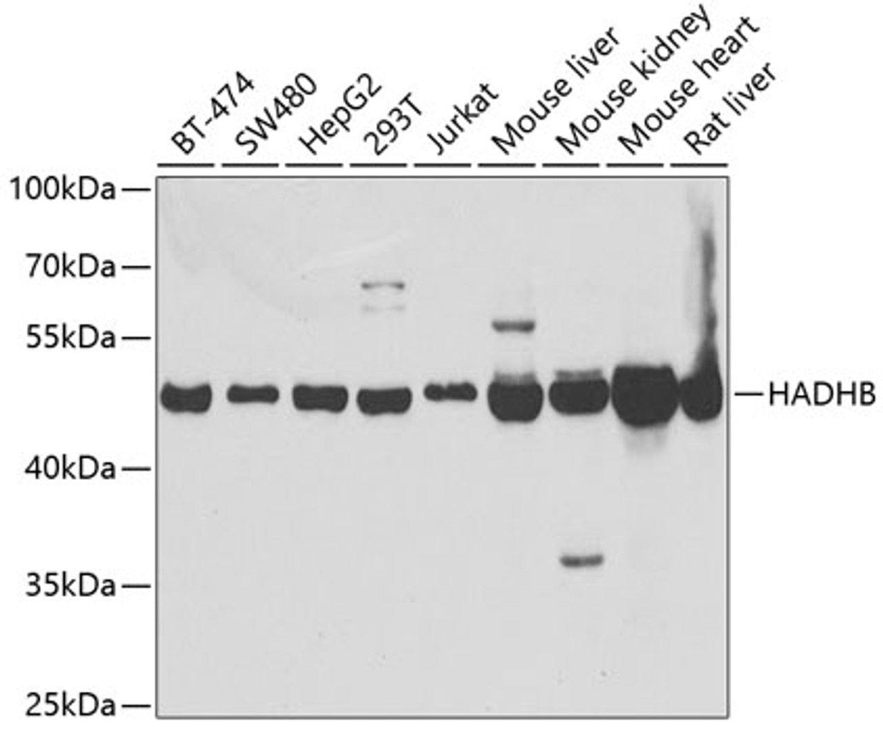 Western blot analysis of extracts of various cell lines using HADHB Polyclonal Antibody at dilution of 1:1000.