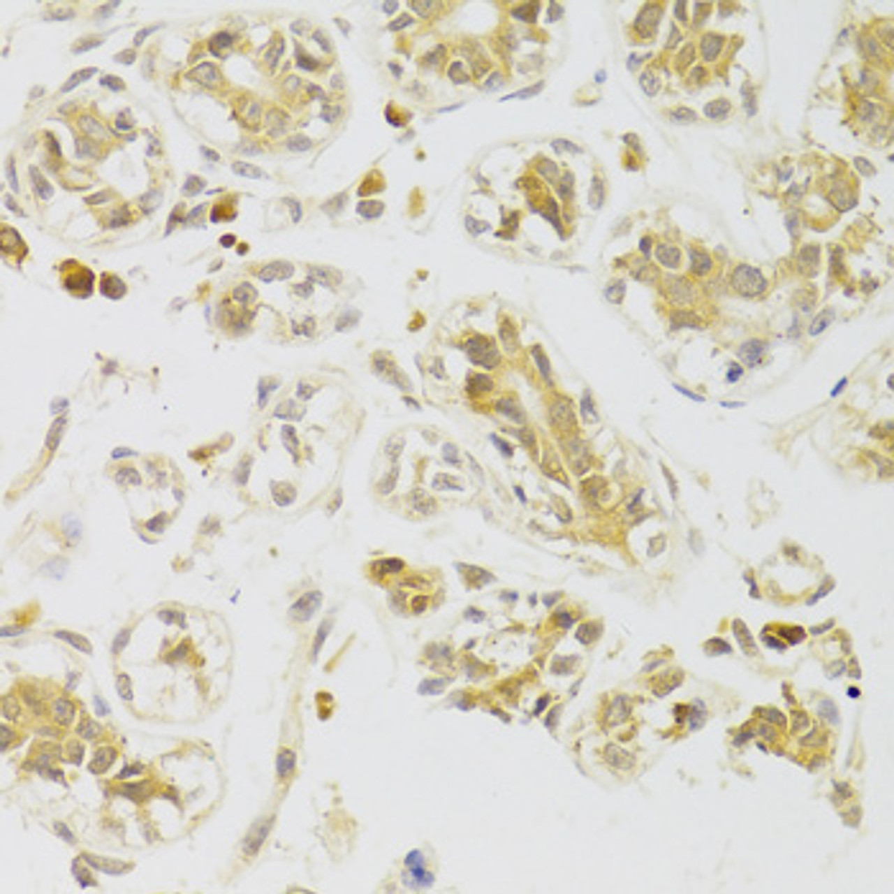 Immunohistochemistry of paraffin-embedded Human breast using Caspase-2 Polyclonal Antibody at dilution of  1:100 (40x lens).