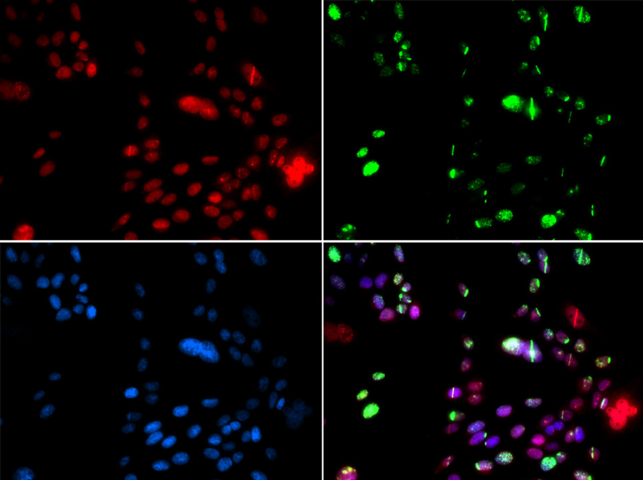 Immunofluorescence analysis of GFP-RNF168 transgenic U2OS cells using PIAS1 Polyclonal Antibody