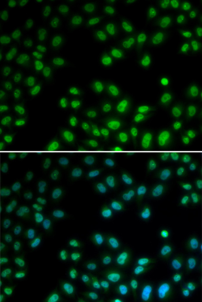 Immunofluorescence analysis of U2OS cells using PIAS1 Polyclonal Antibody
