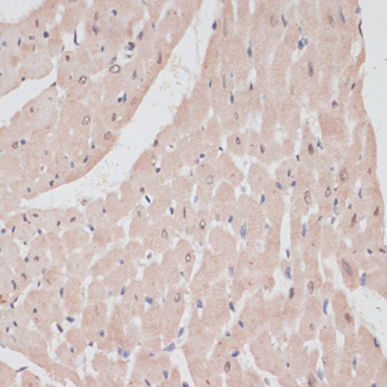 Immunohistochemistry of paraffin-embedded Rat heart using PRPF31 Polyclonal Antibody at dilution of  1:100 (40x lens).