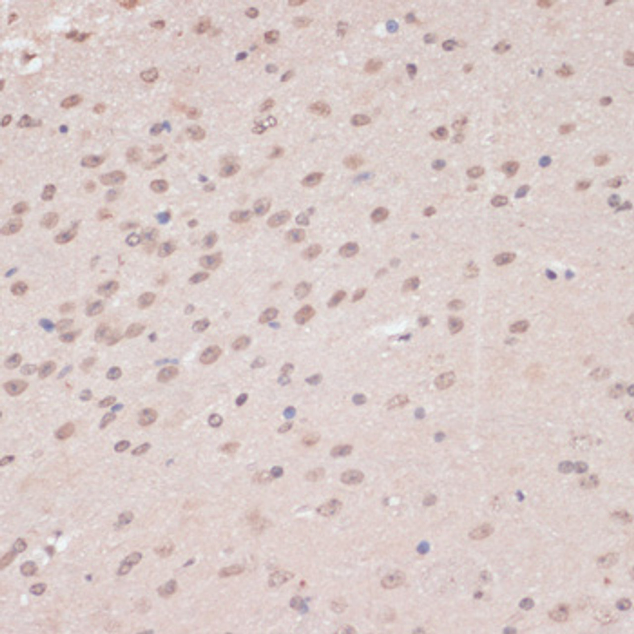 Immunohistochemistry of paraffin-embedded Mouse brain using PRPF31 Polyclonal Antibody at dilution of  1:100 (40x lens).