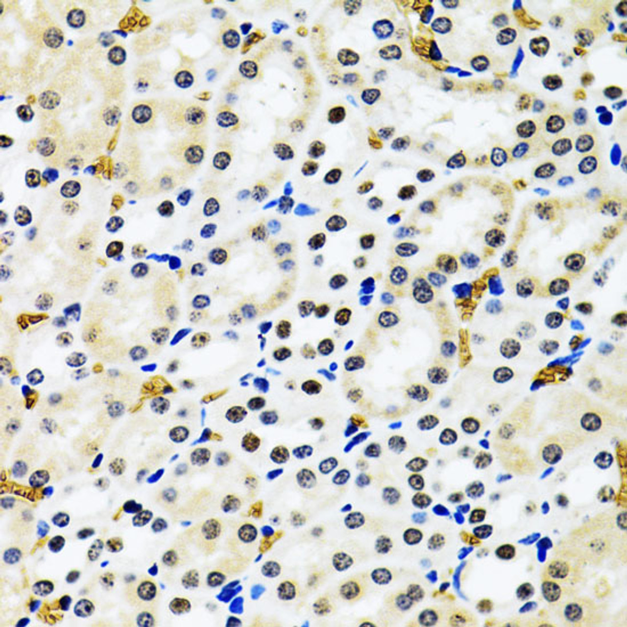 Immunohistochemistry of paraffin-embedded Rat kidney using 53BP1 Polyclonal Antibody at dilution of  1:100 (40x lens).