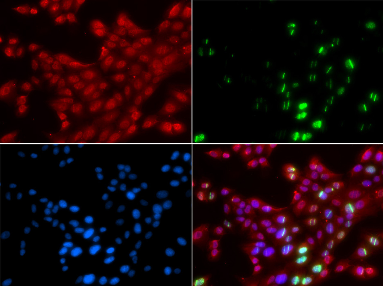 Immunofluorescence analysis of GFP-RNF168 transgenic U2OS cells using 53BP1 Polyclonal Antibody