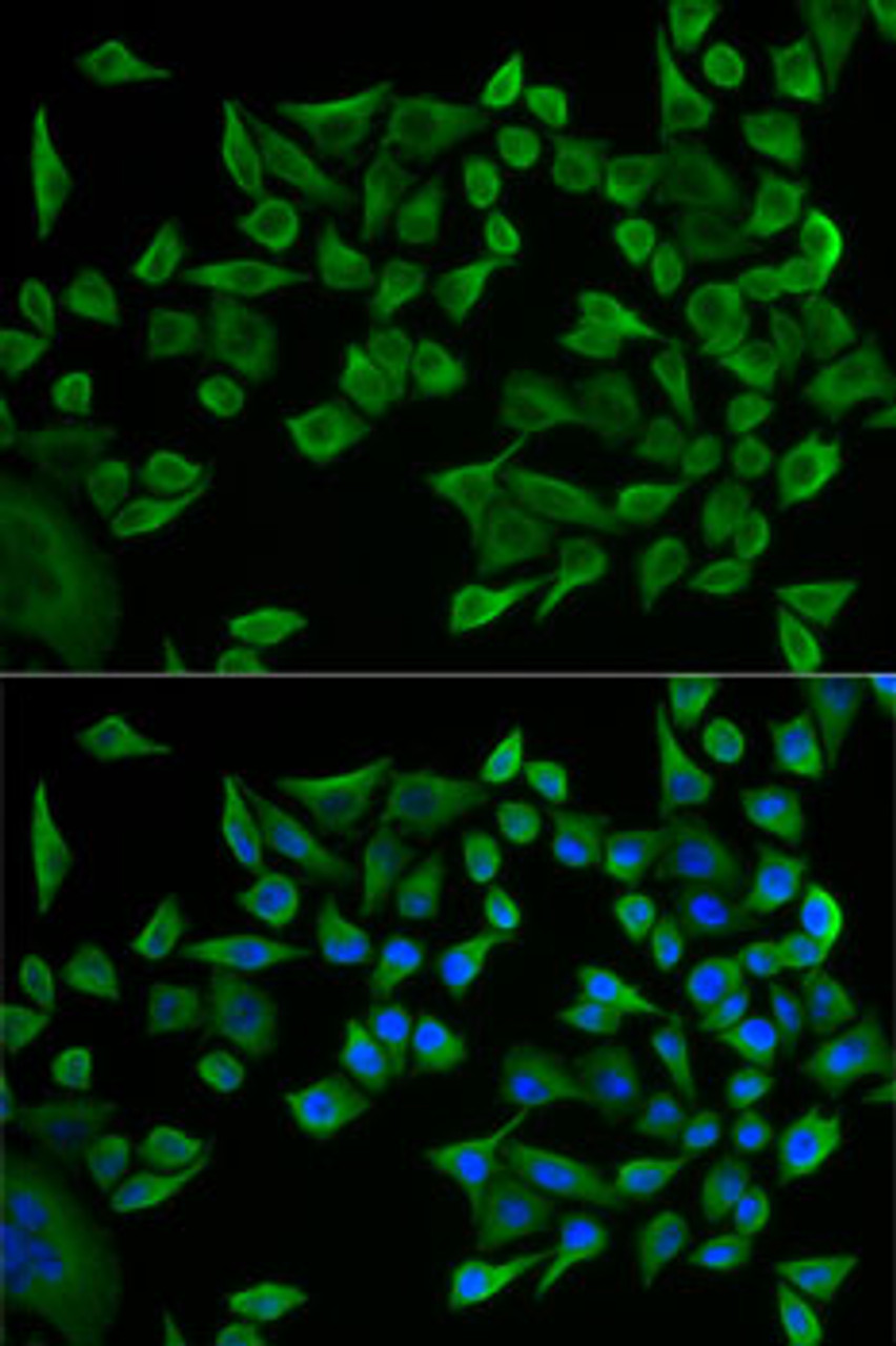 Immunofluorescence analysis of U2OS cells using WARS Polyclonal Antibody
