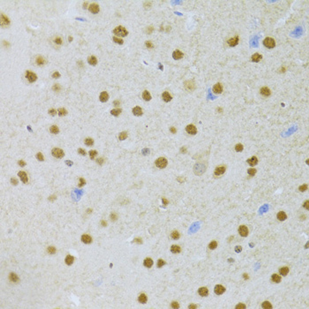 Immunohistochemistry of paraffin-embedded Mouse brain using ANP32A Polyclonal Antibody at dilution of  1:100 (40x lens).
