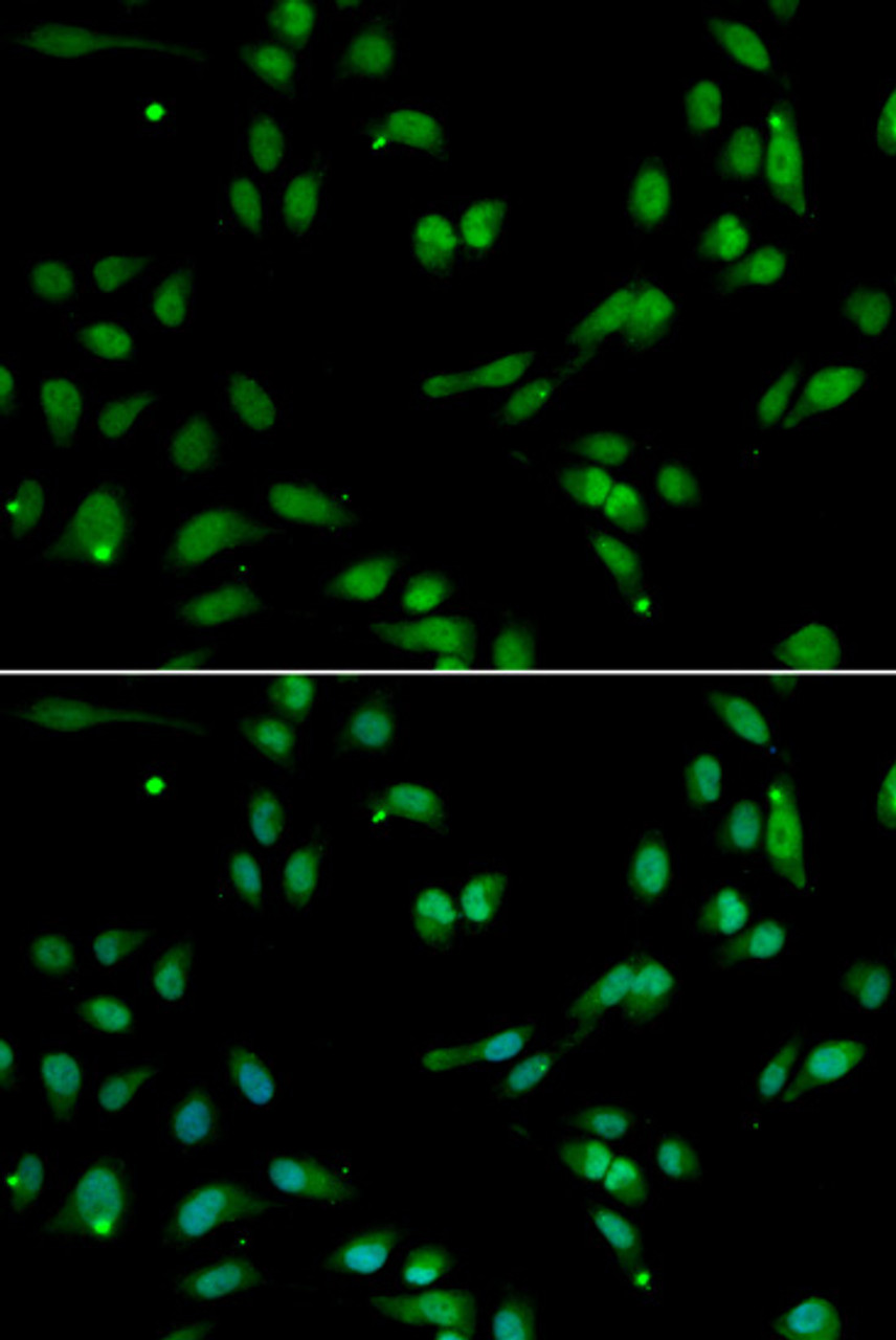 Immunofluorescence analysis of A549 cells using ANP32A Polyclonal Antibody