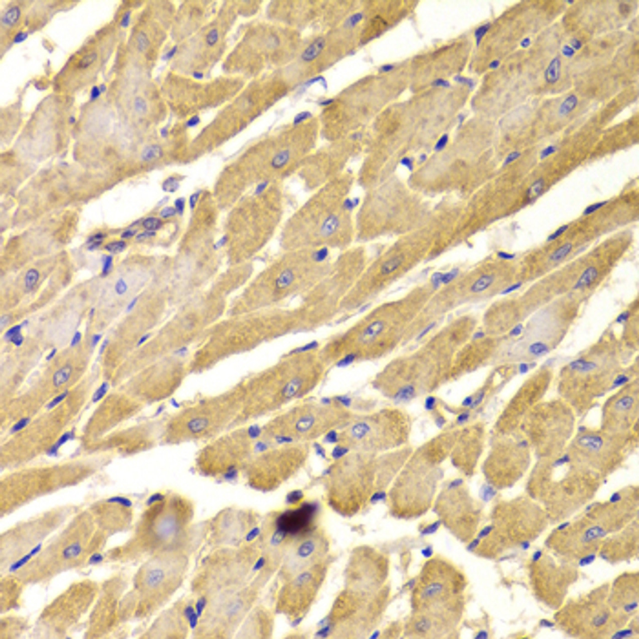 Immunohistochemistry of paraffin-embedded Rat heart using PEX5 Polyclonal Antibody at dilution of  1:100 (40x lens).