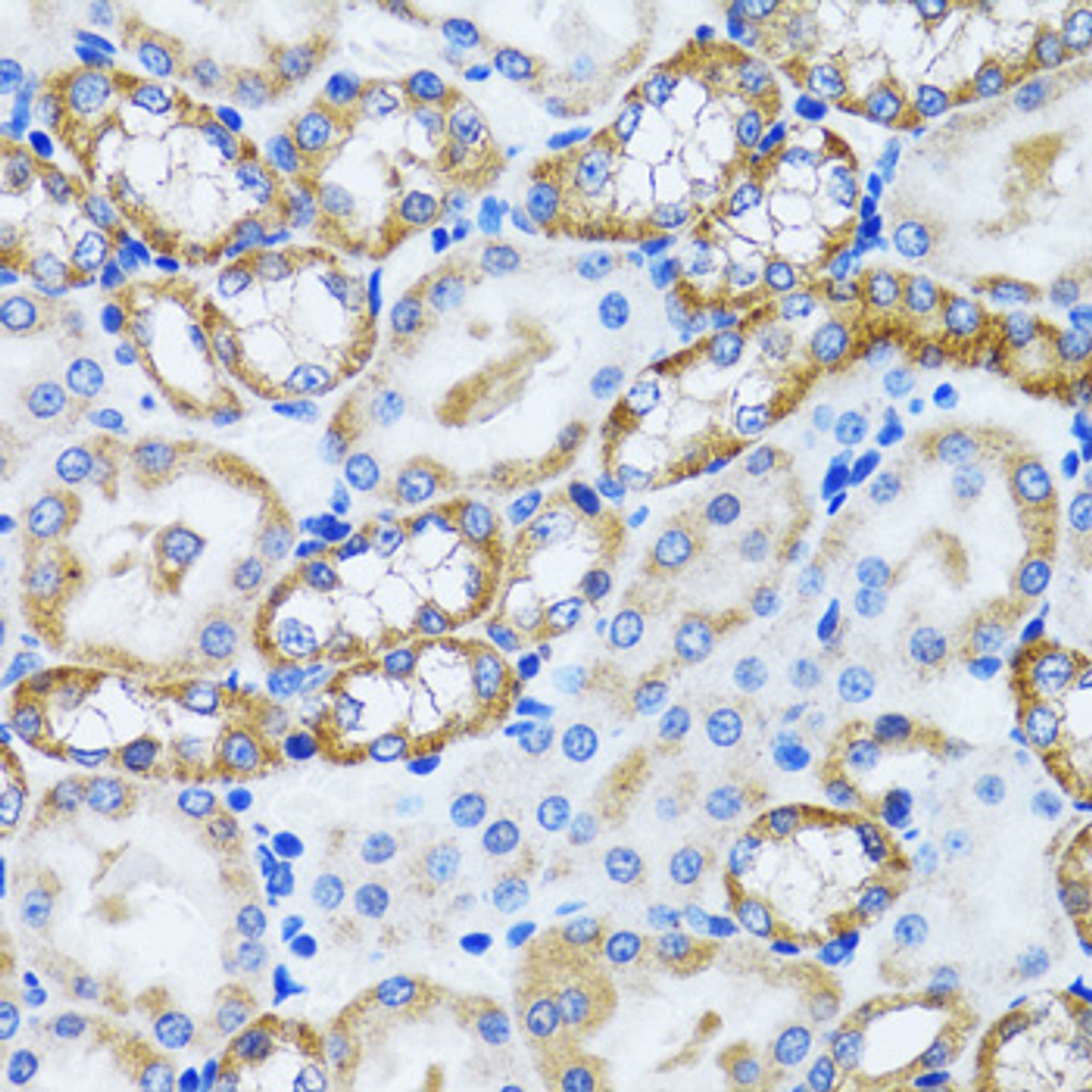 Immunohistochemistry of paraffin-embedded Mouse kidney using PEX5 Polyclonal Antibody at dilution of  1:100 (40x lens).