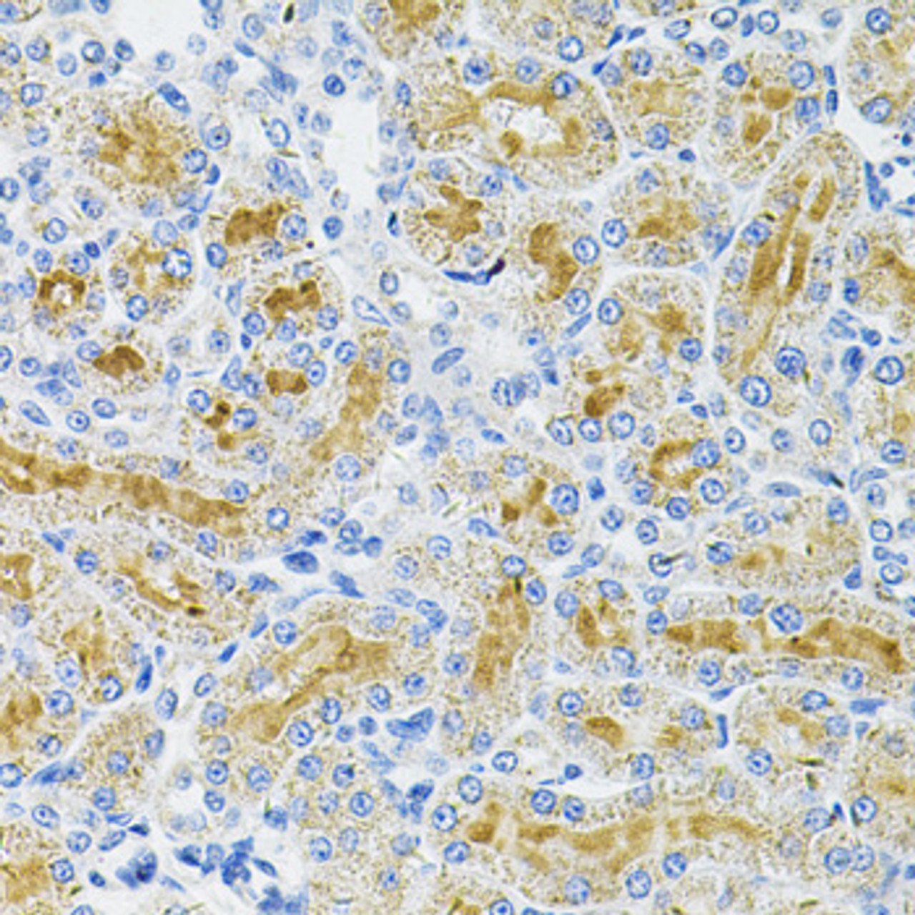 Immunohistochemistry of paraffin-embedded Rat kidney using DDX20 Polyclonal Antibody at dilution of  1:100 (40x lens).
