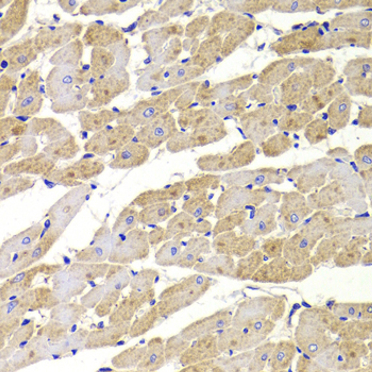 Immunohistochemistry of paraffin-embedded Rat heart using TTC11 / FIS1 Polyclonal Antibody at dilution of  1:100 (40x lens).