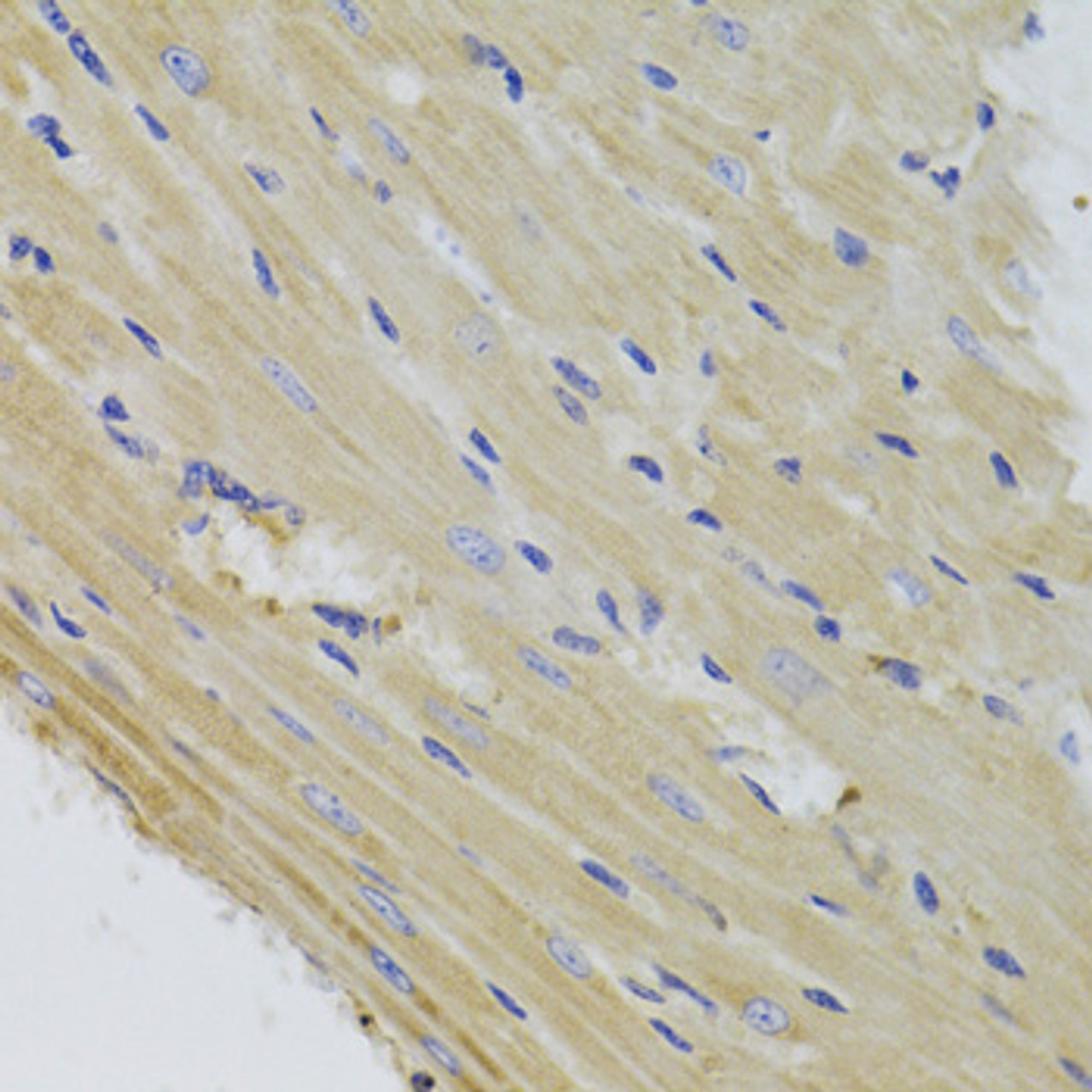 Immunohistochemistry of paraffin-embedded Mouse heart using TTC11 / FIS1 Polyclonal Antibody at dilution of  1:100 (40x lens).