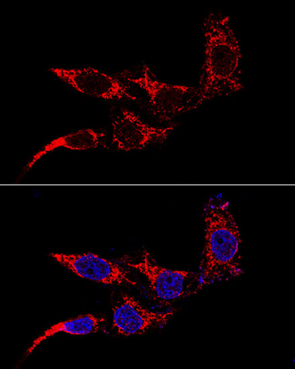 Confocal immunofluorescence analysis of HeLa cells using TTC11 / FIS1 Polyclonal Antibody at dilution of  1:50 (60x lens). Blue: DAPI for nuclear staining.