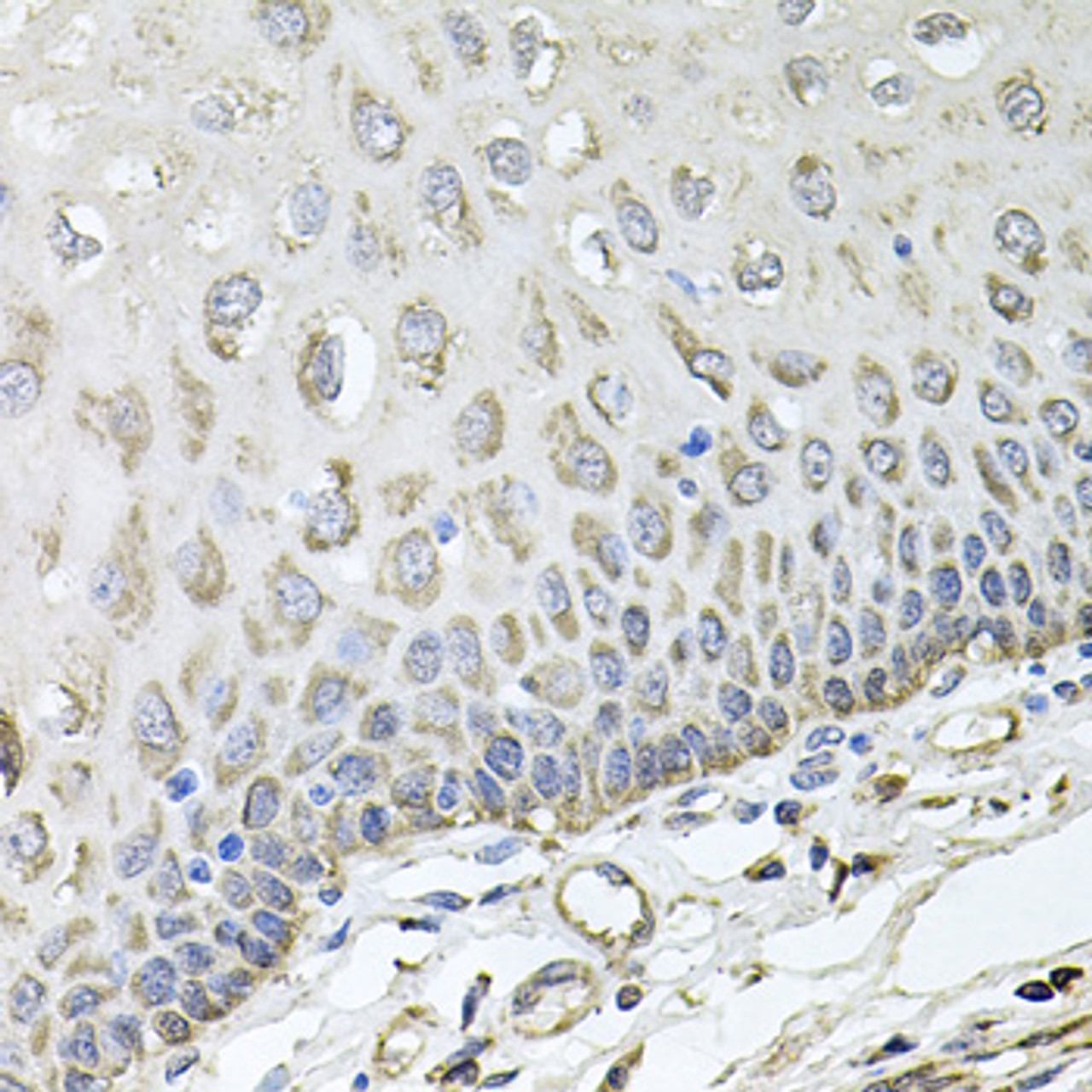 Immunohistochemistry of paraffin-embedded Human esophagus using RHOT1 Polyclonal Antibody at dilution of  1:100 (40x lens).