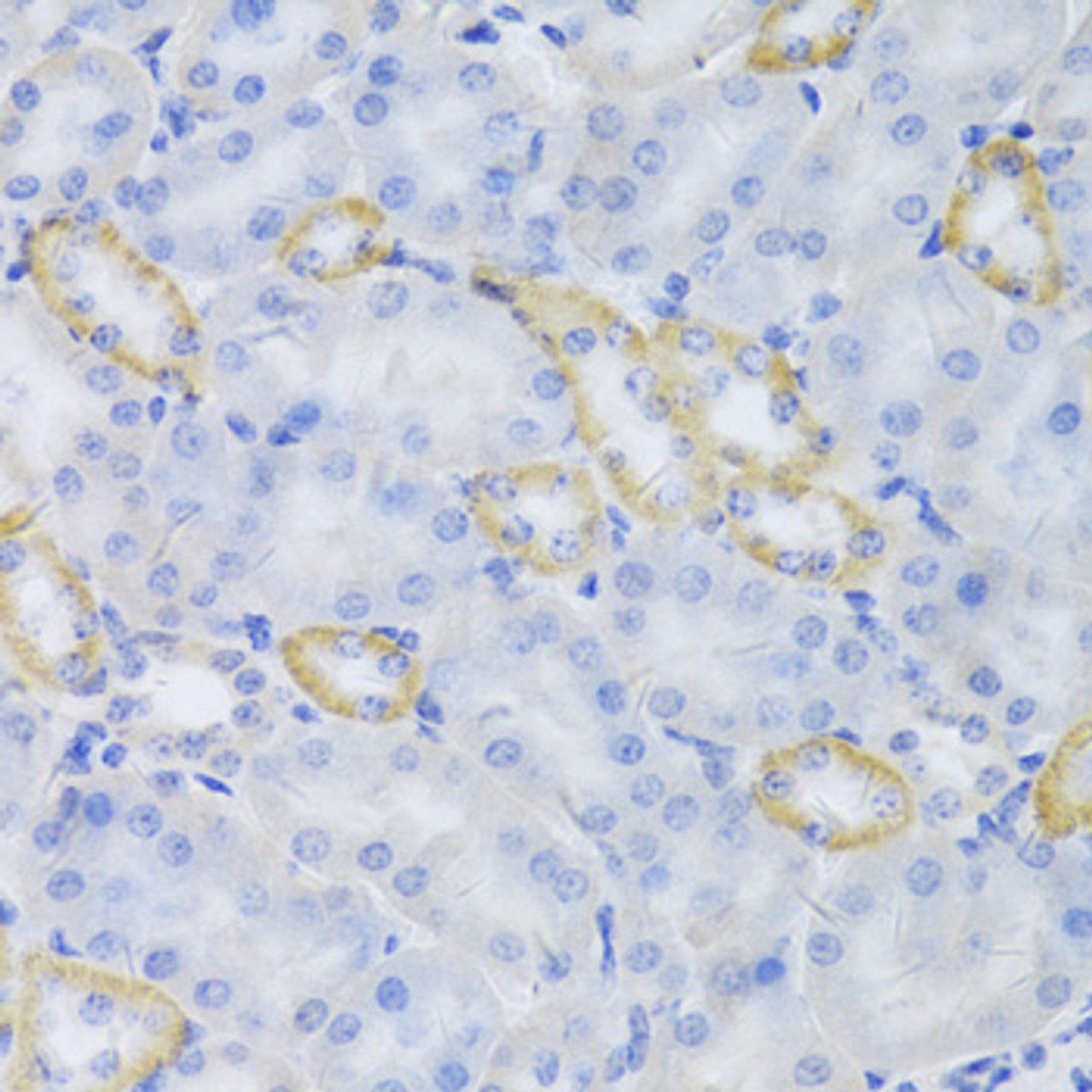 Immunohistochemistry of paraffin-embedded Mouse kidney using MRPS30 Polyclonal Antibody at dilution of  1:100 (40x lens).