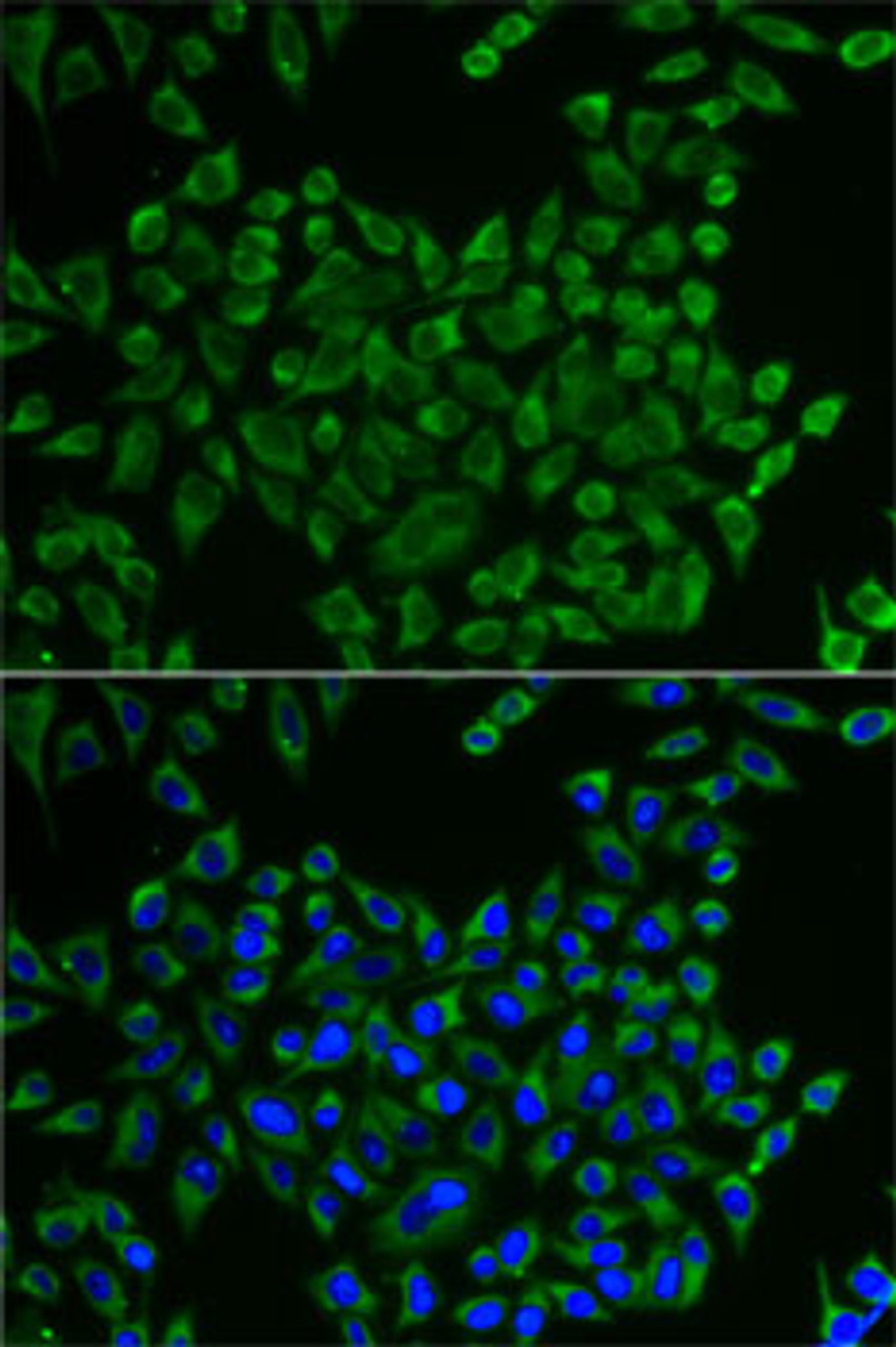 Immunofluorescence analysis of U2OS cells using MRPS30 Polyclonal Antibody