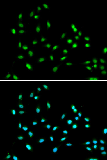 Immunofluorescence analysis of A549 cells using SMARCAD1 Polyclonal Antibody