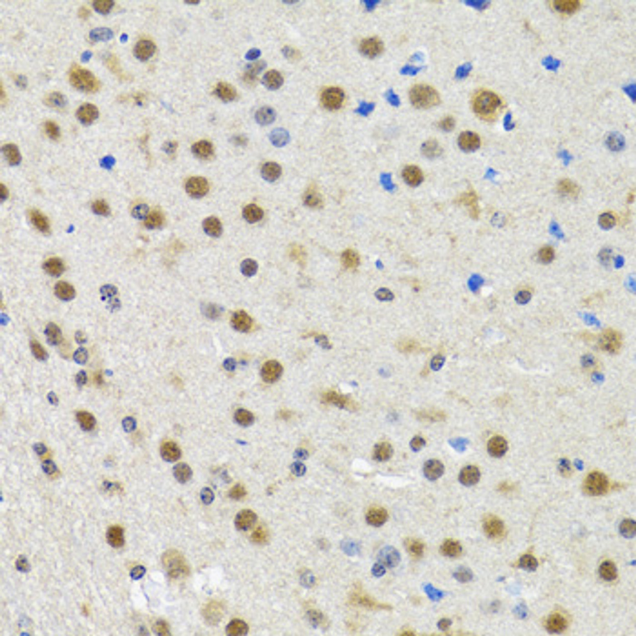 Immunohistochemistry of paraffin-embedded Rat brain using SPIN1 Polyclonal Antibody at dilution of  1:100 (40x lens).
