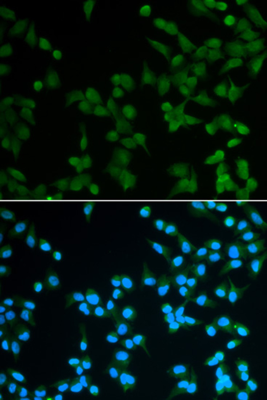 Immunofluorescence analysis of A549 cells using SPIN1 Polyclonal Antibody