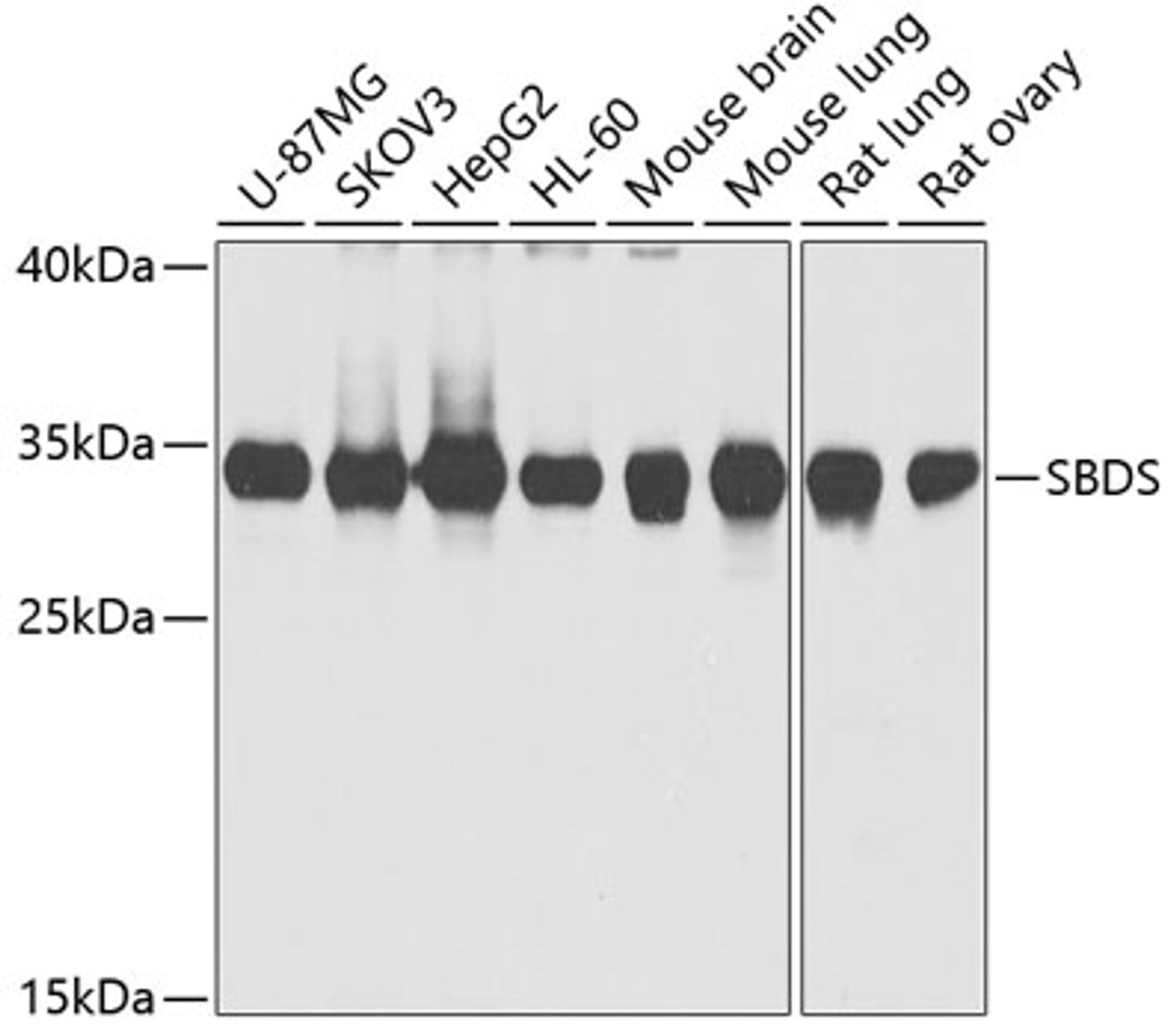 Western blot analysis of extracts of various cell lines using SBDS Polyclonal Antibody at dilution of 1:1000.