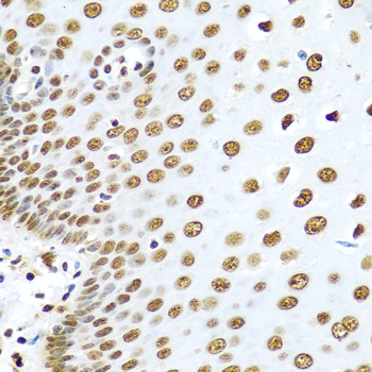 Immunohistochemistry of paraffin-embedded Human esophagus using HNRNPR Polyclonal Antibody at dilution of  1:100 (40x lens).