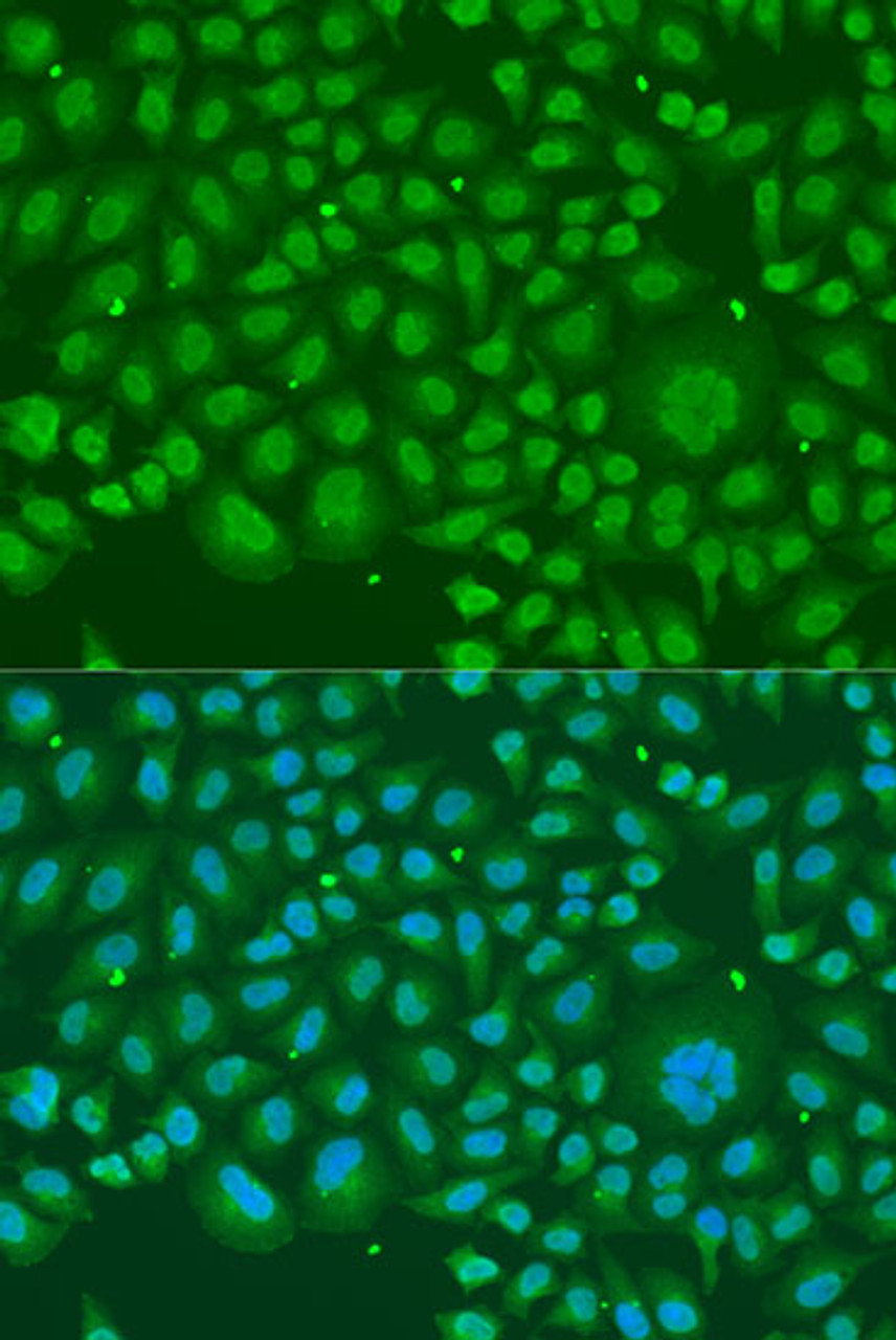 Immunofluorescence analysis of U2OS cells using HNRNPR Polyclonal Antibody at dilution of  1:100. Blue: DAPI for nuclear staining.